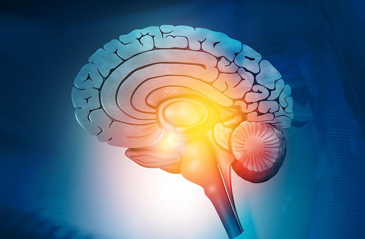 The biological basis of migraine is complex, and varies according to the phase of the migraine. Photograph used for representational purposes only