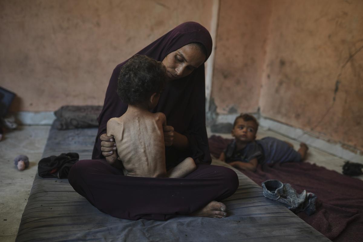 Naima Abu Ful holds her malnourished 2-year-old child, Yazan, at their home in the Shati refugee camp in Gaza City on Wednesday, July 23, 2025. Naima Abu Ful holds her malnourished 2-year-old child, Yazan, at their home in the Shati refugee camp in Gaza City on Wednesday, July 23, 2025.