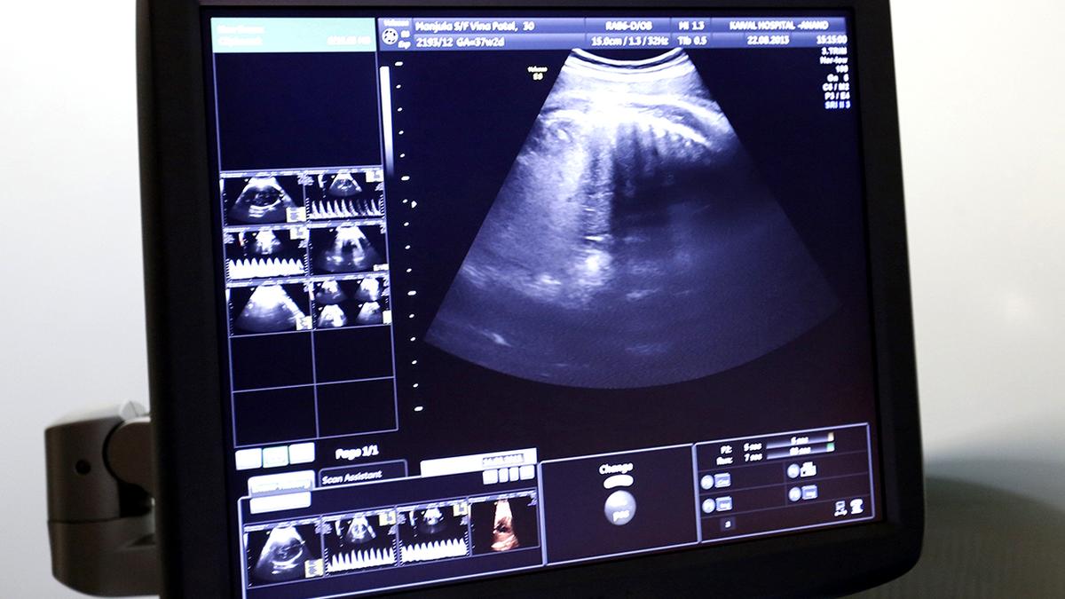 https://th-i.thgim.com/public/incoming/ot9gmt/article70145095.ece/alternates/LANDSCAPE_1200/IMG_06istb_ultrasound_im_2_1_OD8L0EIB.jpg
