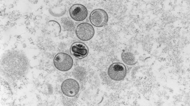Ensure testing for monkeypox, Health Ministry tells States