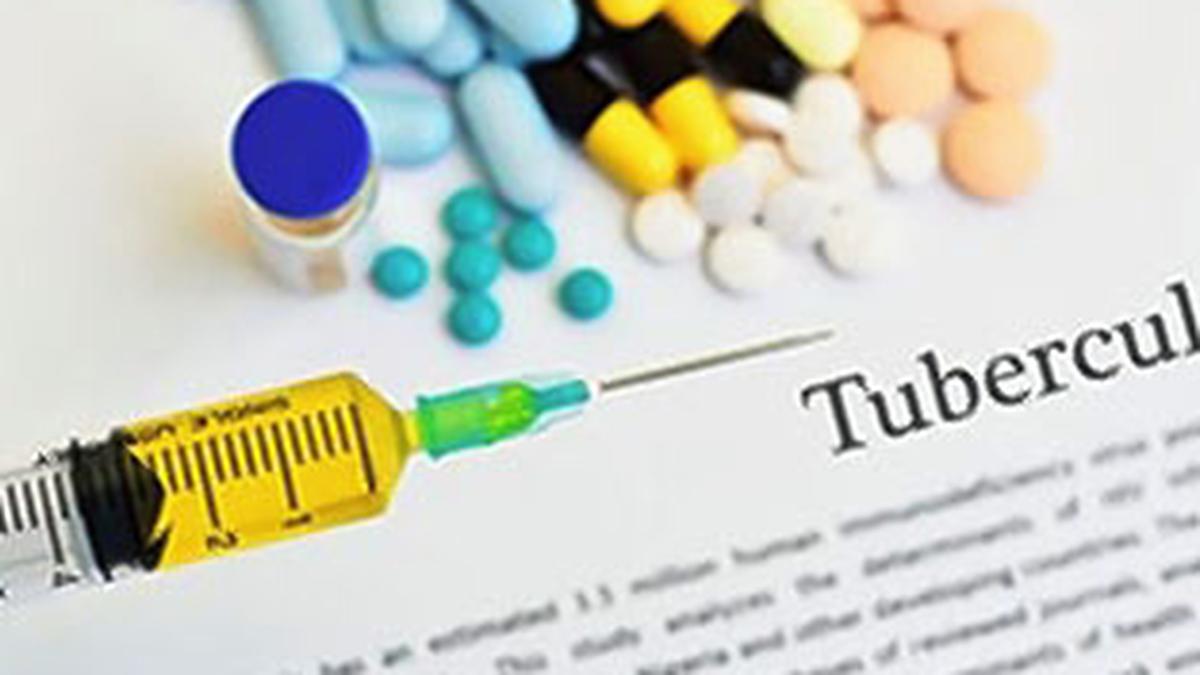 L’absence de données complètes sur la sensibilité aux médicaments chez les patients tuberculeux peut entraîner une amplification de la résistance : étude
