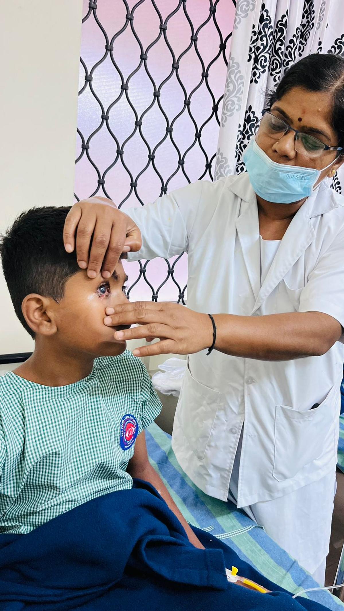 A child being treated at Minto Hospital for eye injuries sustained while bursting crackers in Bengaluru on Friday. A child being treated at Minto Hospital for eye injuries sustained while bursting crackers in Bengaluru on Friday.