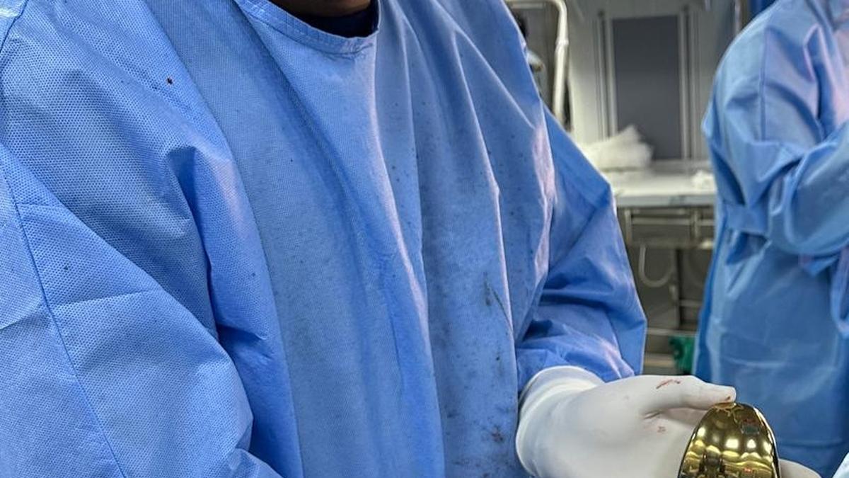 Rare knee replacement procedure carried out in Belagavi hospital