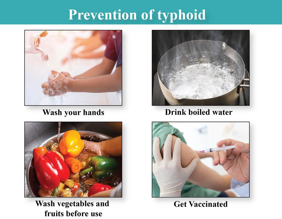Typhoid Fever What parents should know Rainbow Children #39 s Hospital