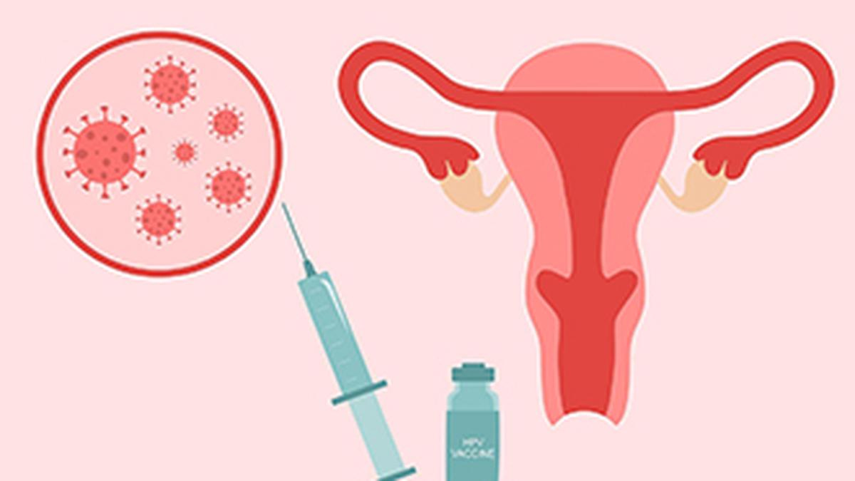 All you need to know about: cervical cancer
Premium