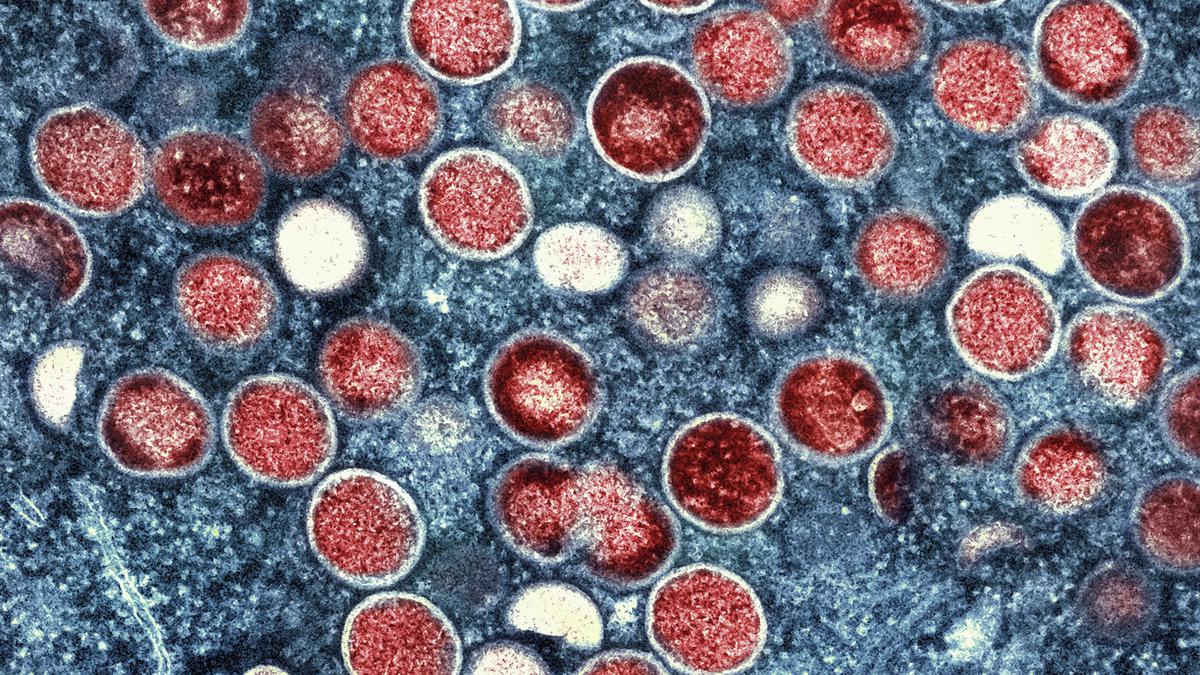 The ‘genomic accordion’ mpox viruses use to evolve, infect humans
Premium