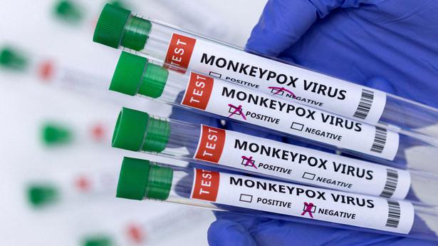 Study finds three asymptomatic monkeypox cases