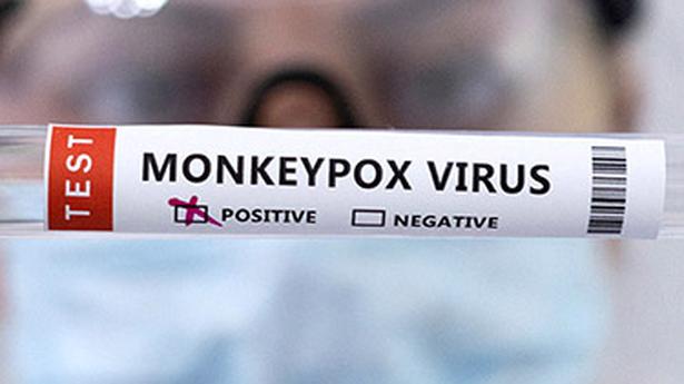 L’épidémie mondiale de monkeypox dépasse les 50 000 cas