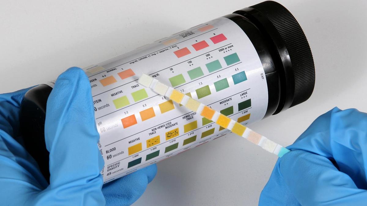 Preventing recurrent urinary tract infections