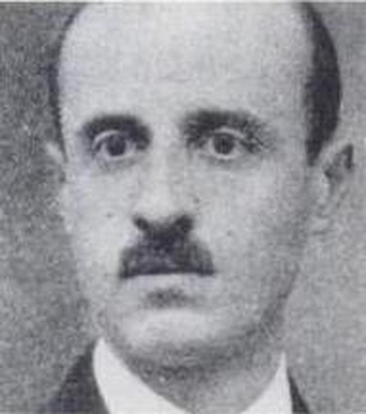 It is said that the disease derives its name from Spanish neuropathologist Gonzalo Rodríguez Lafora, who first documented it in an adolescent patient who was experiencing progressive myoclonic epilepsy. It is said that the disease derives its name from Spanish neuropathologist Gonzalo Rodríguez Lafora, who first documented it in an adolescent patient who was experiencing progressive myoclonic epilepsy.