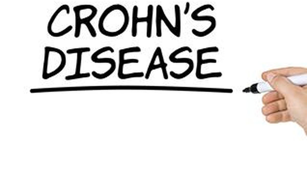 All you need to know about: Crohn’s disease