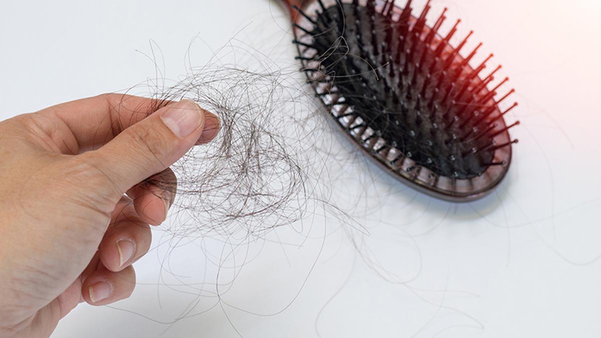 Indo-US research collaboration identifies cholesterol’s role in irreversible hair loss