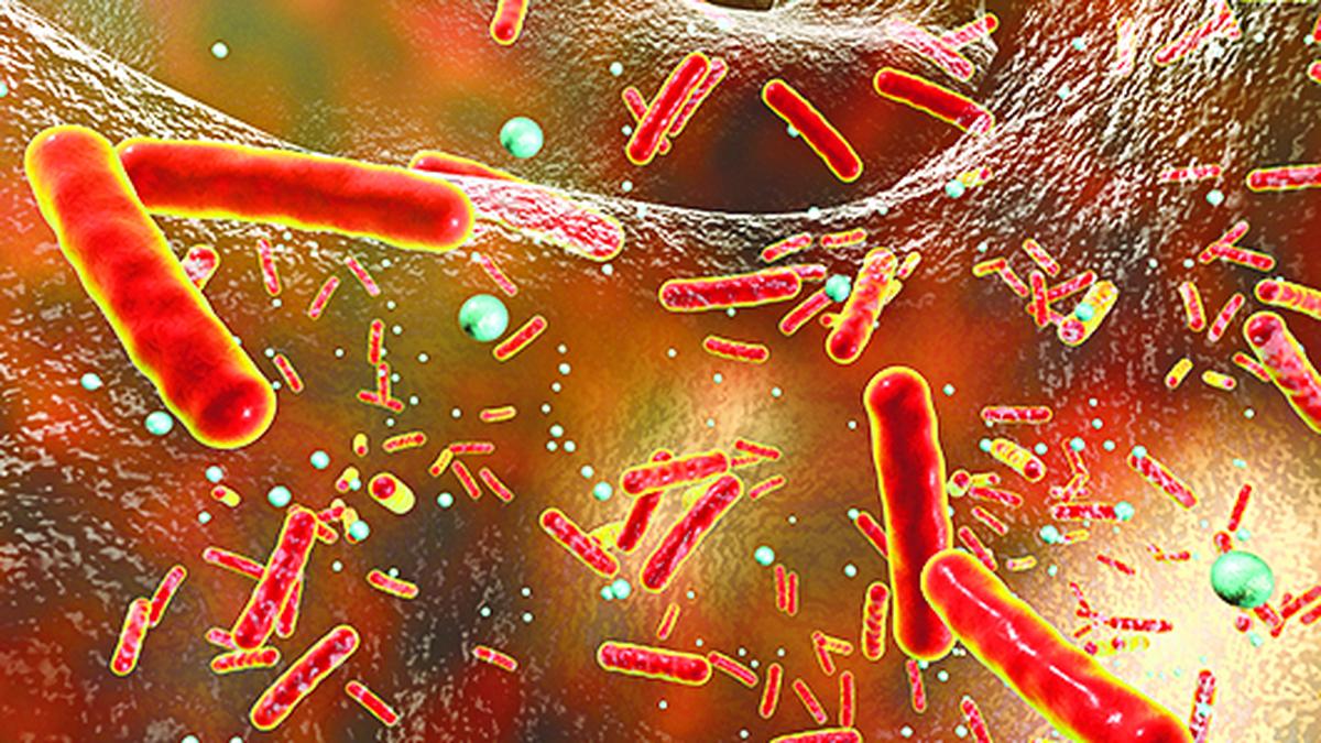 All you need to know about: sepsis