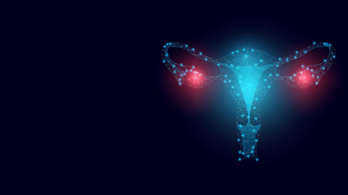 Understanding ovarian cancer: its causes, symptoms, and screening methods