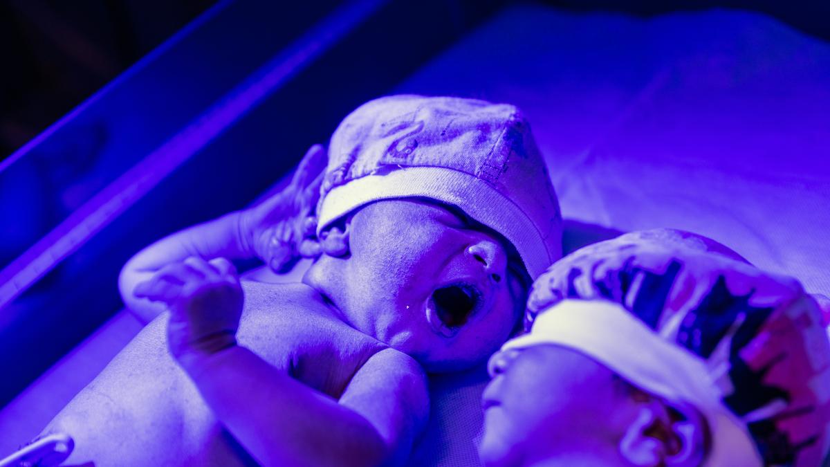 What happens when newborns don’t cry after birth?
Premium