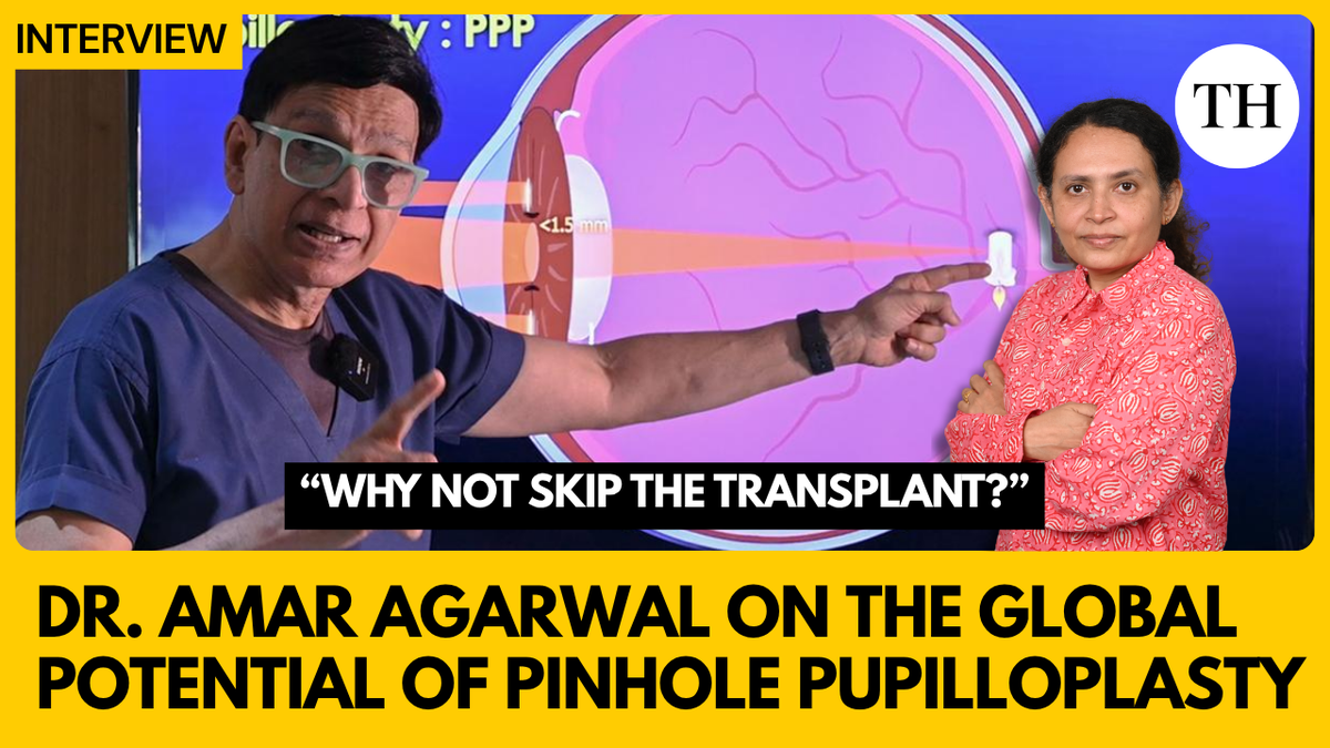 Pinhole Pupilloplasty: A simple alternative to corneal transplant surgery