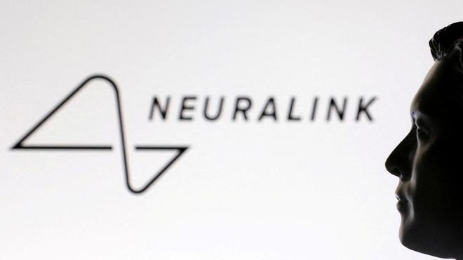Neuralink039s-speech-restoration-device-gets-FDA039s-039breakthrough039-tag