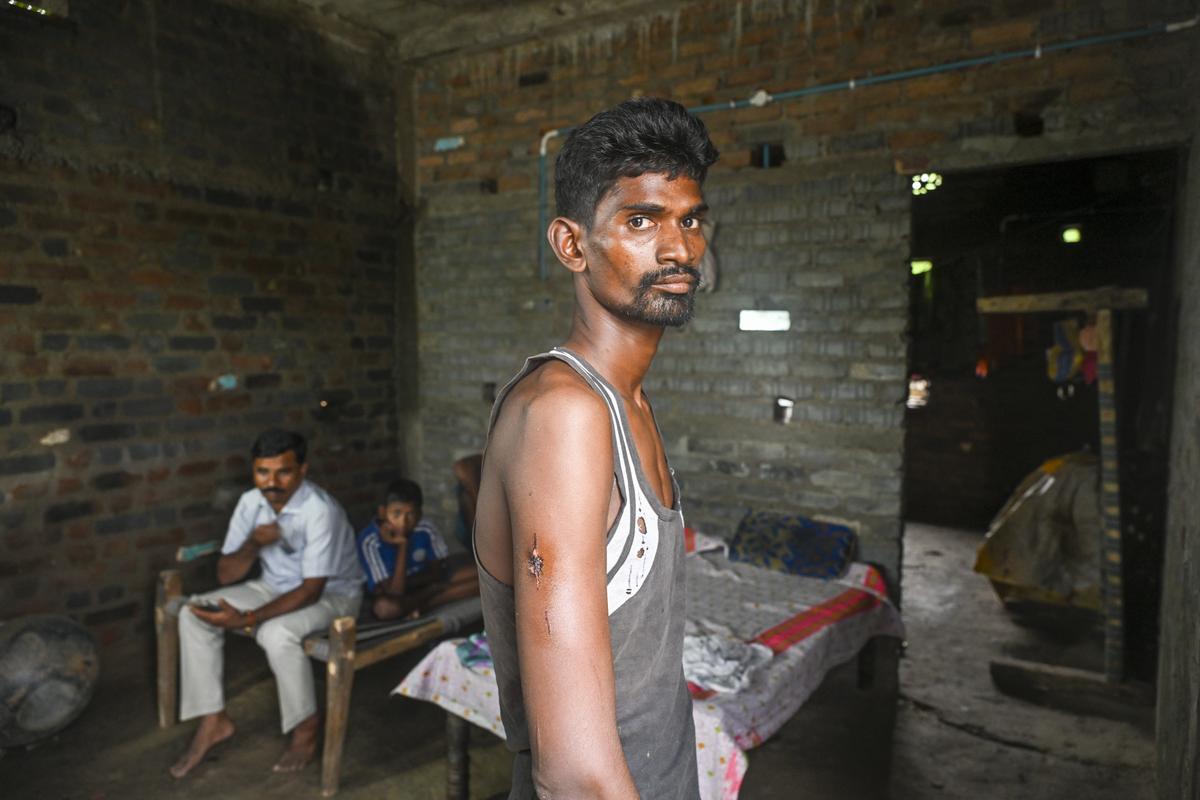 Bir kaplan saldırısından kurtulan Maruti Karanshya, Chandrapur, Marageon'daki evinde.  