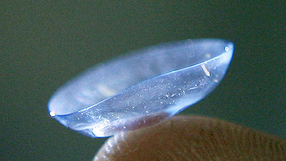 MAHE doctors develop selfmoisturising contact lens The Hindu