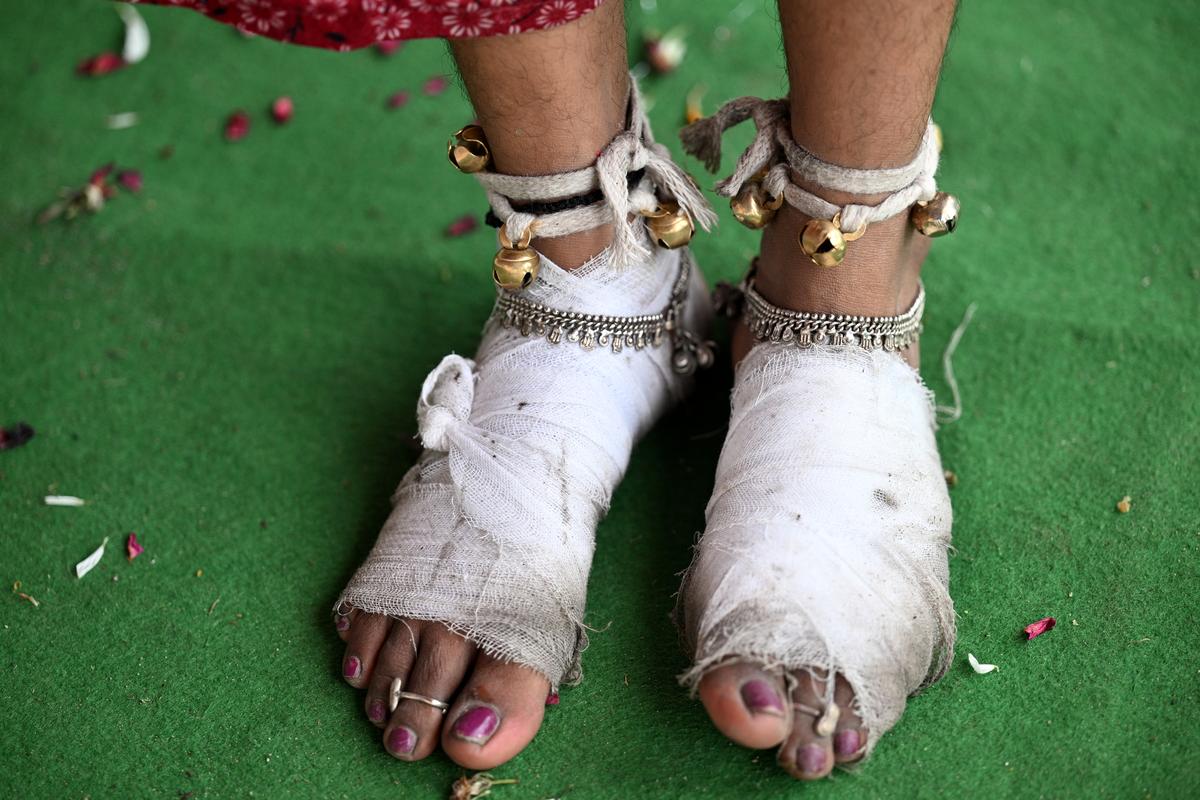 The injured feet of a female devotee.