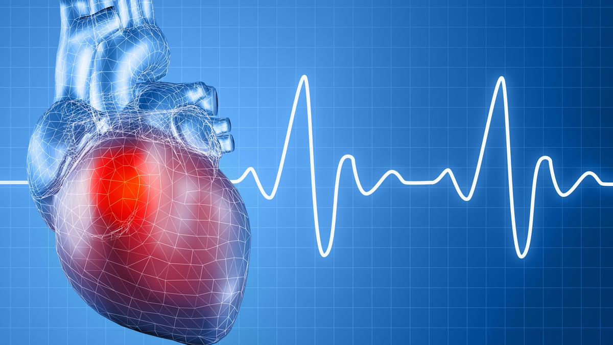 One in four patients who suffered a major heart attack had no known risk factors, Madras Medical College study finds