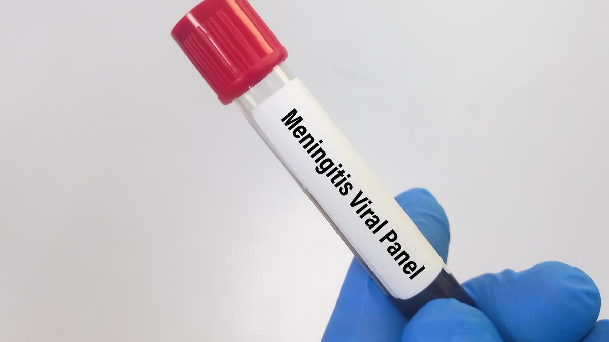 What is viral meningitis?