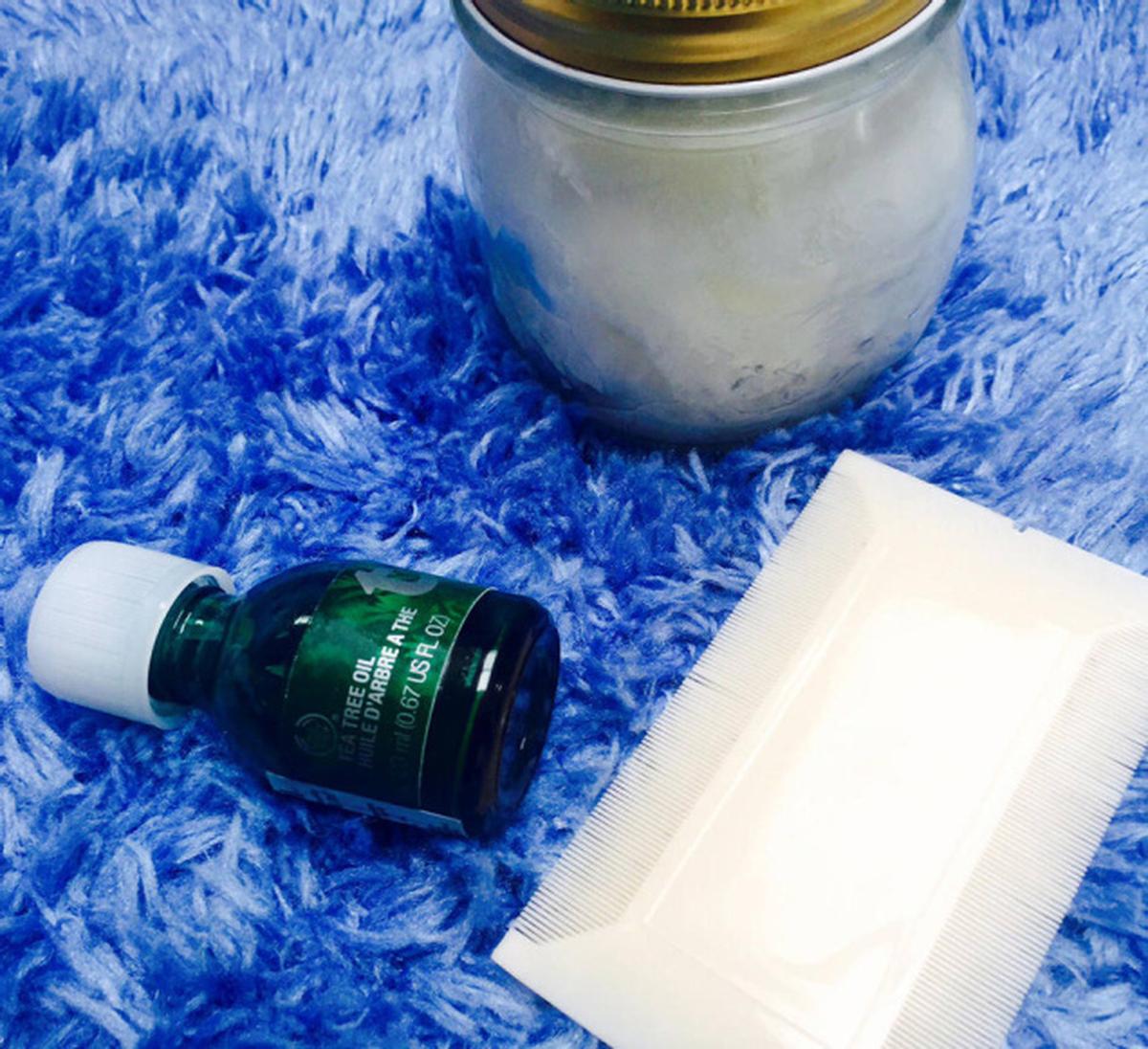 The cleanup act How to get rid of hair lice The Hindu