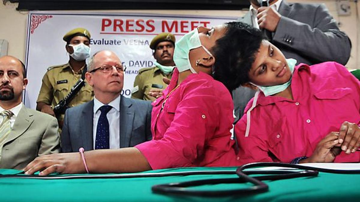 Conjoined twins, Veena and Vani, see a glimmer of hope The Hindu