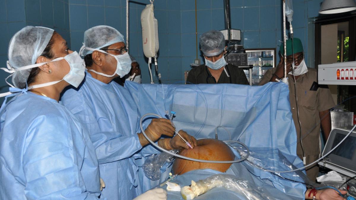 Fetoscopy technique saves atrisk twin foetuses The Hindu