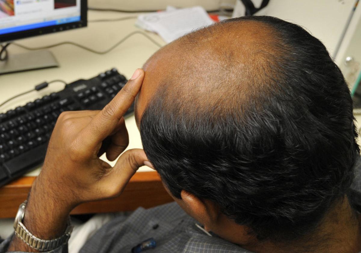 bald guy selfies average hat