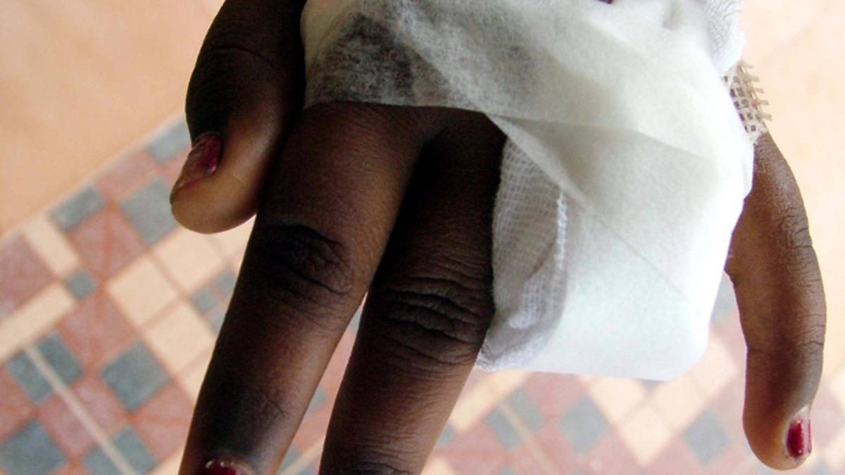 Bandages will change colour if wound not healing right in future The