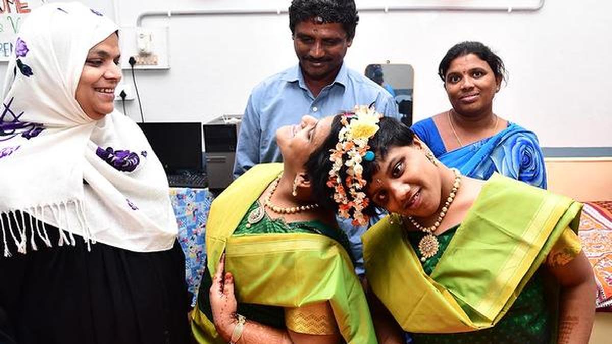 Happy birthday twice over for Hyderabad’s conjoined twins The Hindu