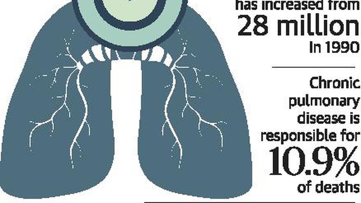 New hope for patients with lung ailments - The Hindu