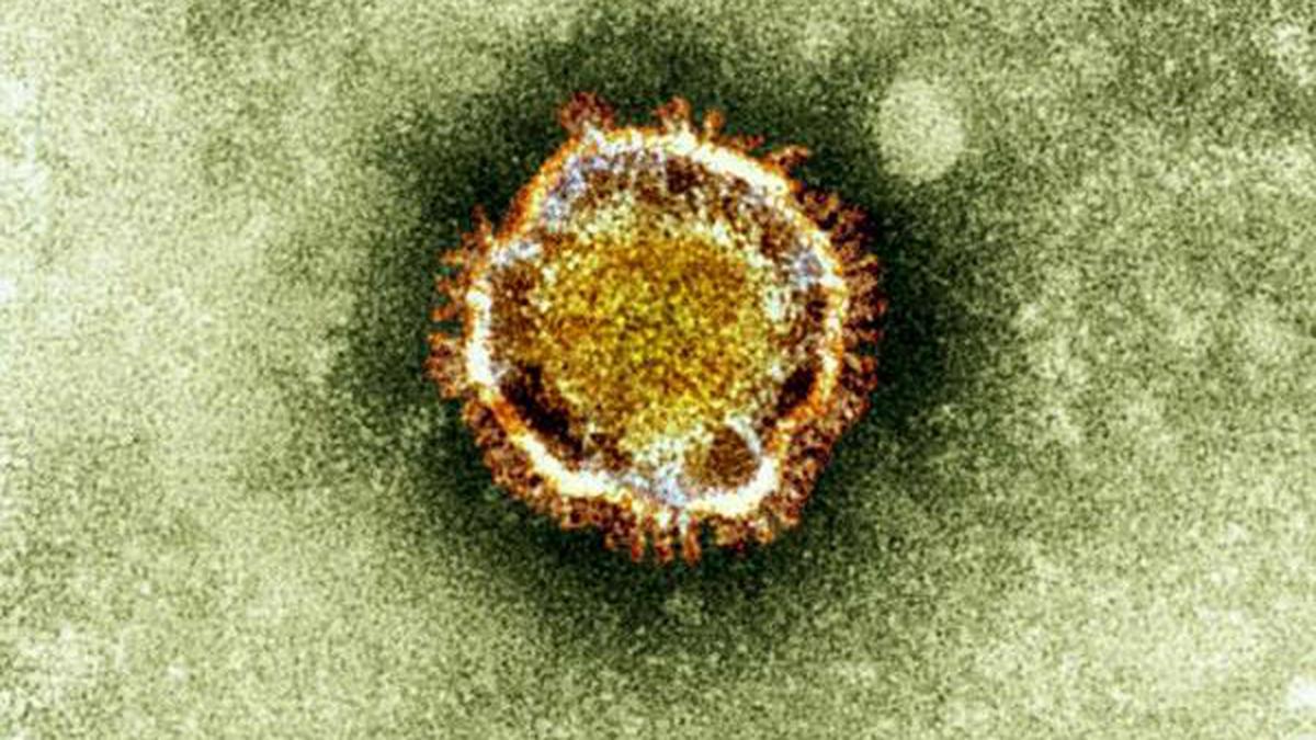 Epidemic vs. pandemic? Glossary of terms for virus outbreak