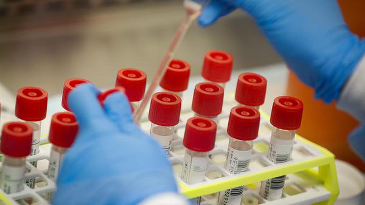 Coronavirus | Four ICMR labs to become approval centres for test kits