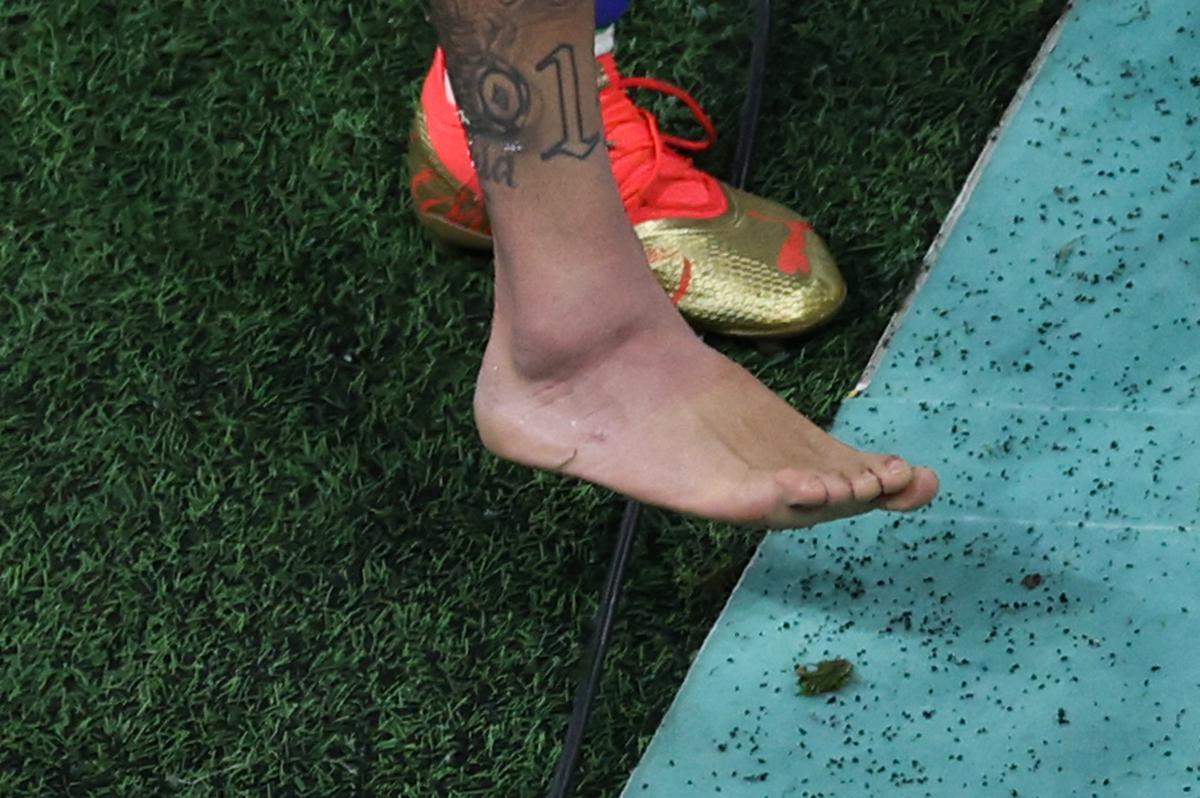 Picture of the swollen ankle of Brazil’s forward Neymar taken as he leaves the field at the end of the Qatar 2022 World Cup Group G football match between Brazil and Serbia at the Lusail Stadium in Lusail, north of Doha on November 24, 2022. 