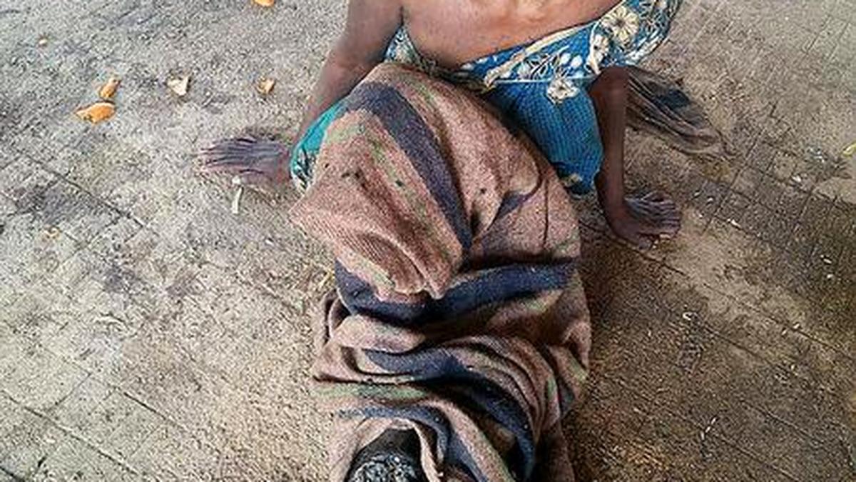 A woman’s sad plight at govt. hospital - The Hindu