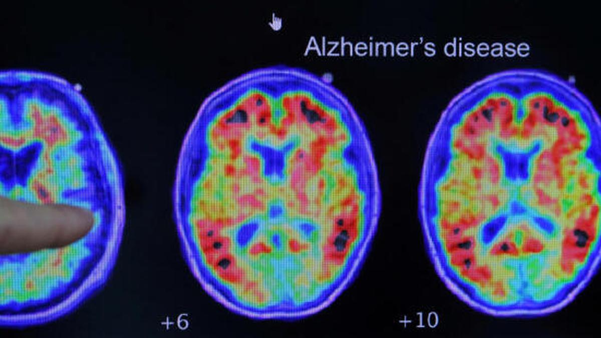 Take our quiz - Think Brain Health - Alzheimer's Research UK