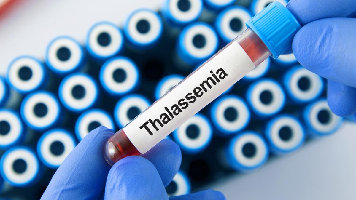 Thalassemia patients call for standardised tests to reduce transfusion-transmitted infections