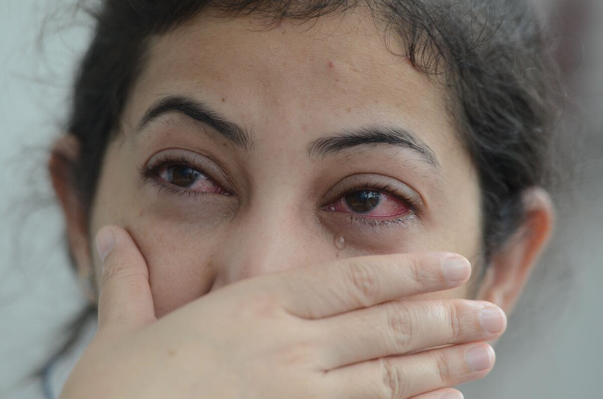 Conjunctivitis is self-limiting but ensure rest for about a week, administration tells people