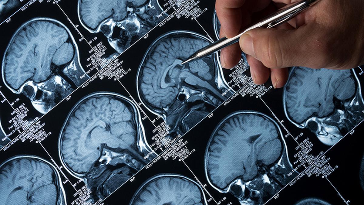 Brain-eating amoeba: Two children cured of amoebic encephalitis in Kerala