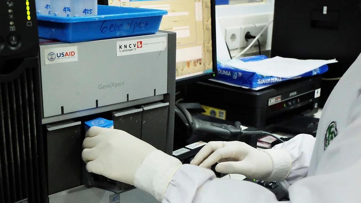 Over-reliance on smear microscopy for TB detection continues
Premium