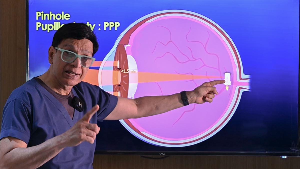 Hole in one: Pinhole pupilloplasty emerges as alternative to corneal transplants