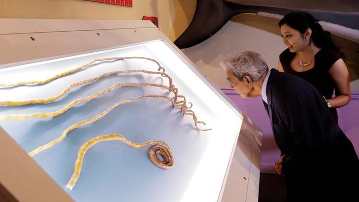 Shridhar Chillal s hand permanently disabled for not cutting nails for 66 years The Hindu