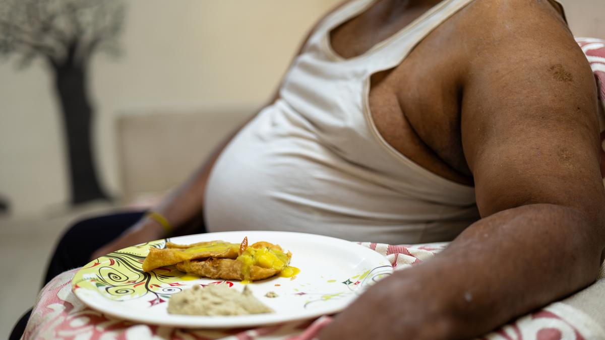 India’s burden of rising obesity, the hefty cost to pay