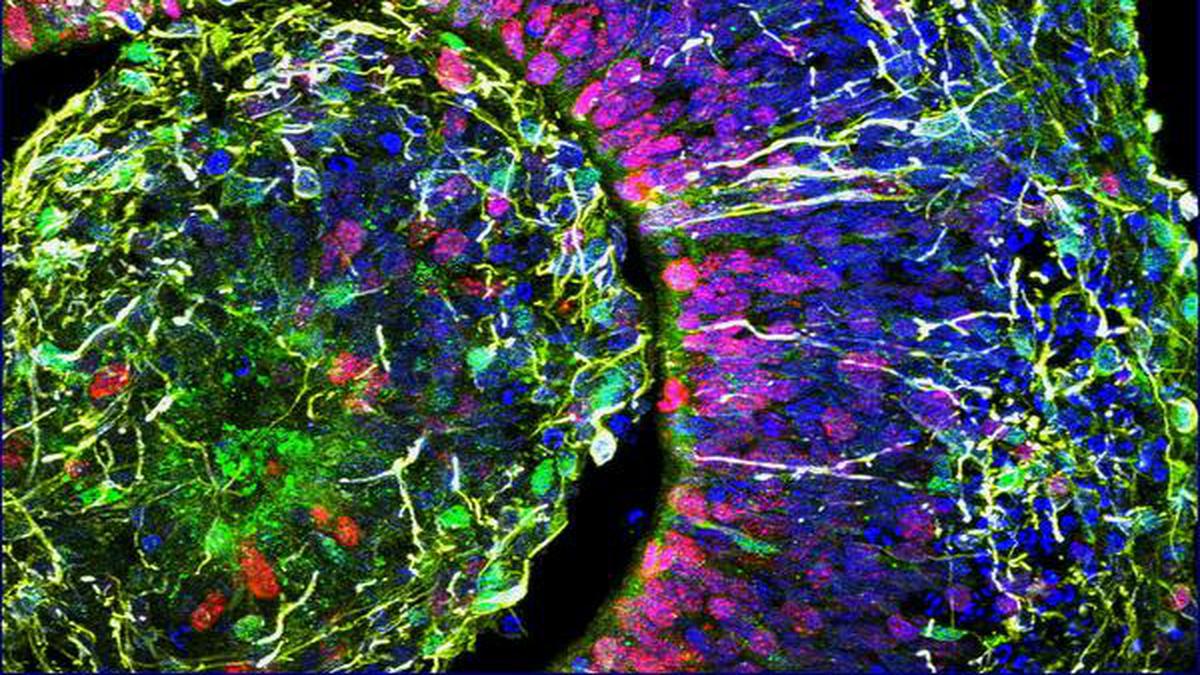 Can organoids, derived from stem cells, be used in disease treatments?