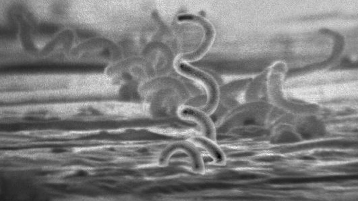 Rising antimicrobial resistance in STIs being seen in India: experts 
Premium