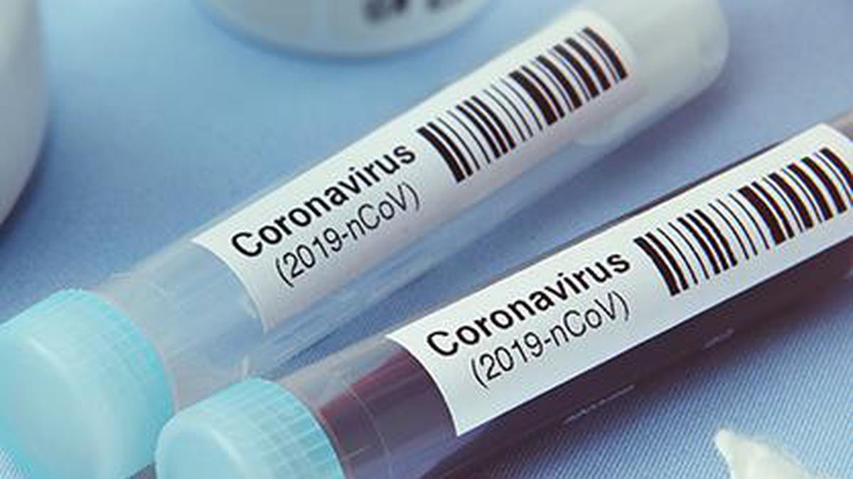 Coronavirus | IIT-Delhi team develops cheap COVID-19 test