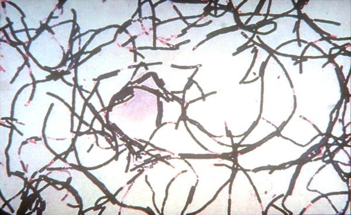 бацилла сибирской язвы bacillus anthracis. Bacillus anthracis сибирская язва. бацилла антрацис микробиология. бациллюс антрацис сибирская язва. бациллы сибирской язвы микроскопия.