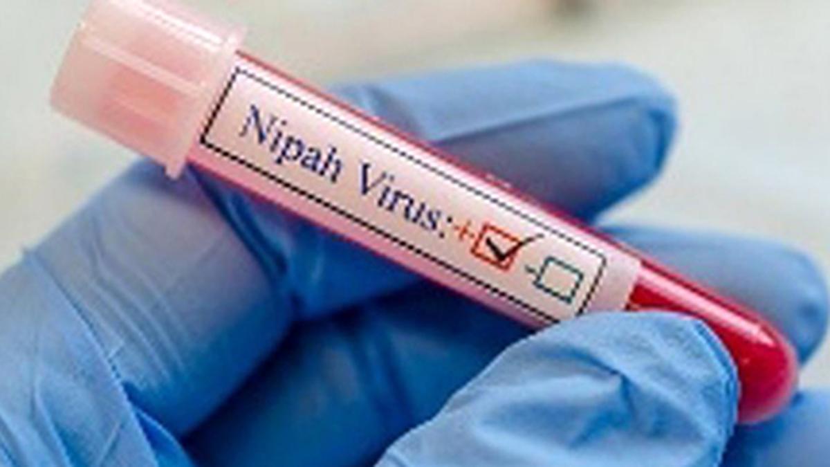 Nipah virus confirmed kills 24-year-old man in Kerala